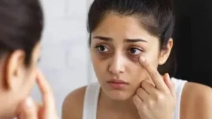 सिर्फ नींद की कमी नहीं ये 5 कारण भी बन सकते हैं डार्क सर्कल्स की वजह, आज ही हो जाएं आप सावधान…