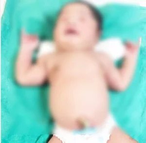 मेडिकल कॉलेज डिमरापाल में अनोखा केस: सिजेरियन ऑपरेशन से जन्मा 5 किलो से अधिक वजन का नवजात, ICU में निगरानी जारी